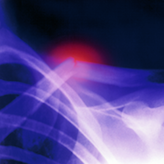 Medical Photo NHS Lothian/Science Photo Library